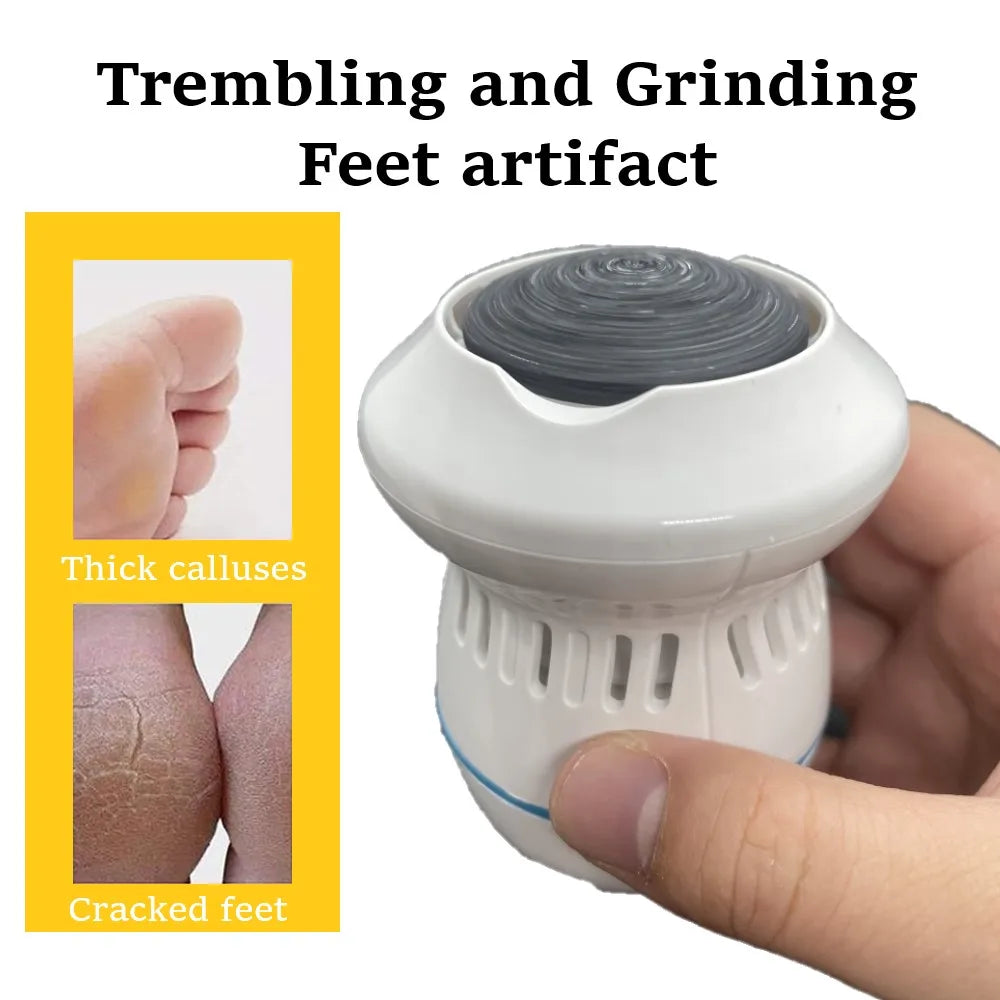 Best Electric Foot Callus Remover